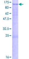 Human BOP1 Protein (Recombinant GST)