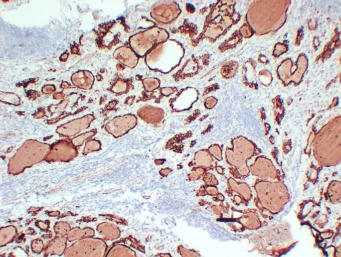 PathPlus™ TPO / Thyroid Peroxidase Antibody