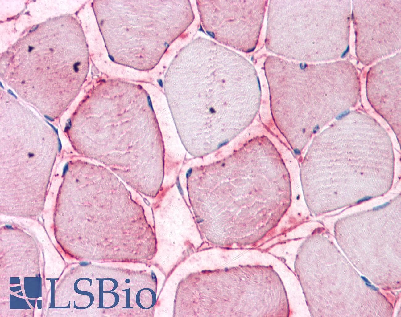 IHC-plus™ SEMA4B / Semaphorin 4B Antibody (Internal)