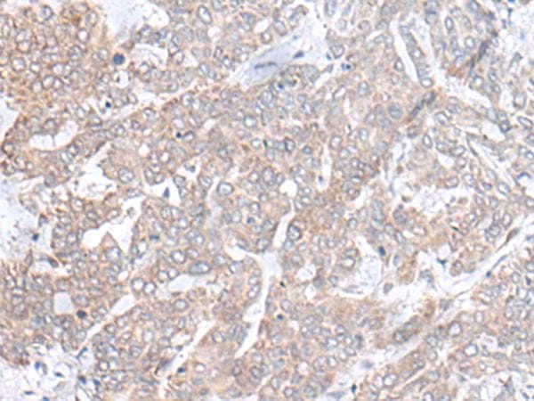 PLGLB2 / PLGLB1 Antibody