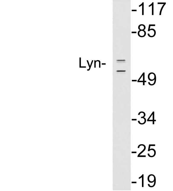 LYN Antibody (aa149-198)