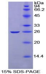 Rat CR2 / CD21 Protein (Recombinant His-T7)