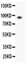 POSTN / Periostin Antibody (aa24-41)
