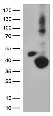 DHRS1 Antibody (clone OTI4C12, Carrier-free)