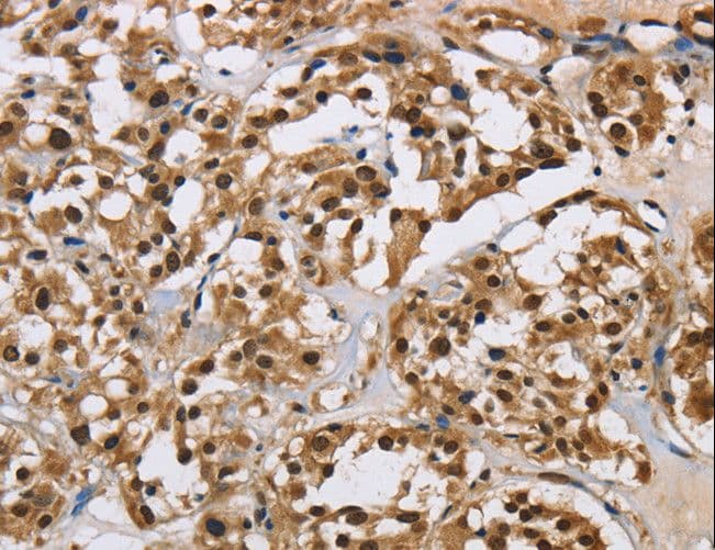 HNRNPL / hnRNP L Antibody
