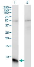 Monoclonal Mouse anti-Human GNGT1 Antibody (clone 1F8, WB)