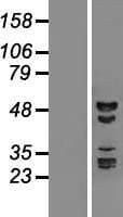 RBM41 Protein (Over-Expression Lysate Myc-DDK (Flag))