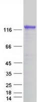Human DAB2IP Protein (Recombinant Myc-DDK (Flag))