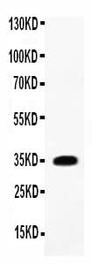Polyclonal Rabbit anti-Rat IL-1B / IL-1 Beta Antibody (aa117-268, WB)