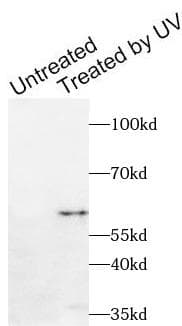 CHEK1 / CHK1 Antibody (phospho-Ser280)
