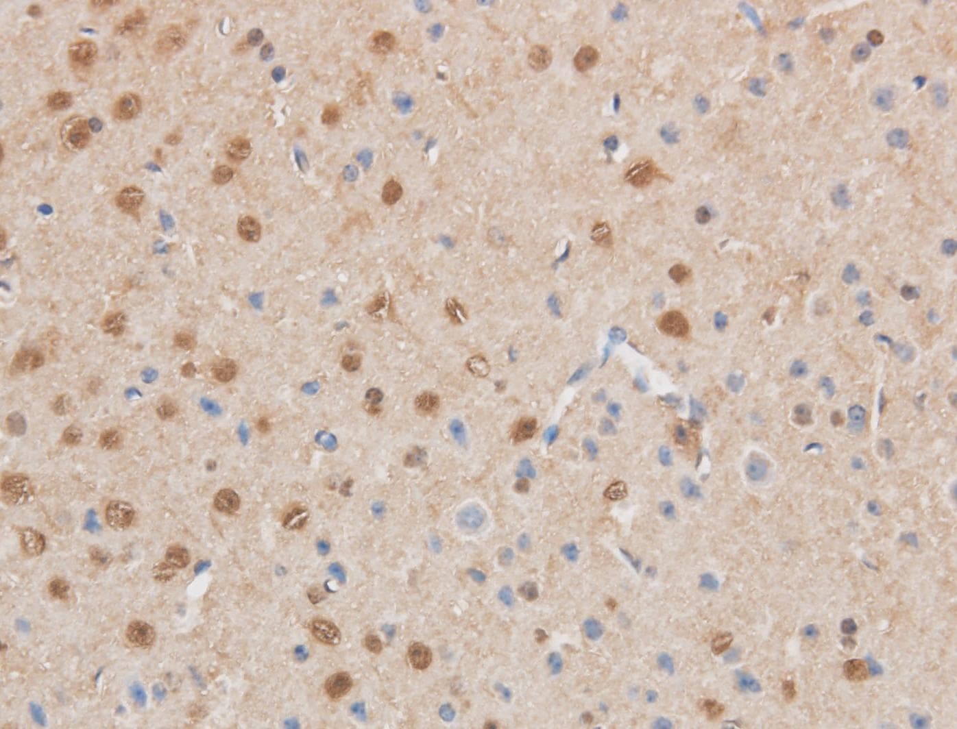 MAP2K6 / MEK6 / MKK6 Antibody