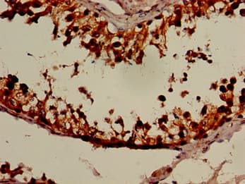 Polyclonal Rabbit anti-Human NANOS3 / NOS-3 Antibody (IHC, IF)