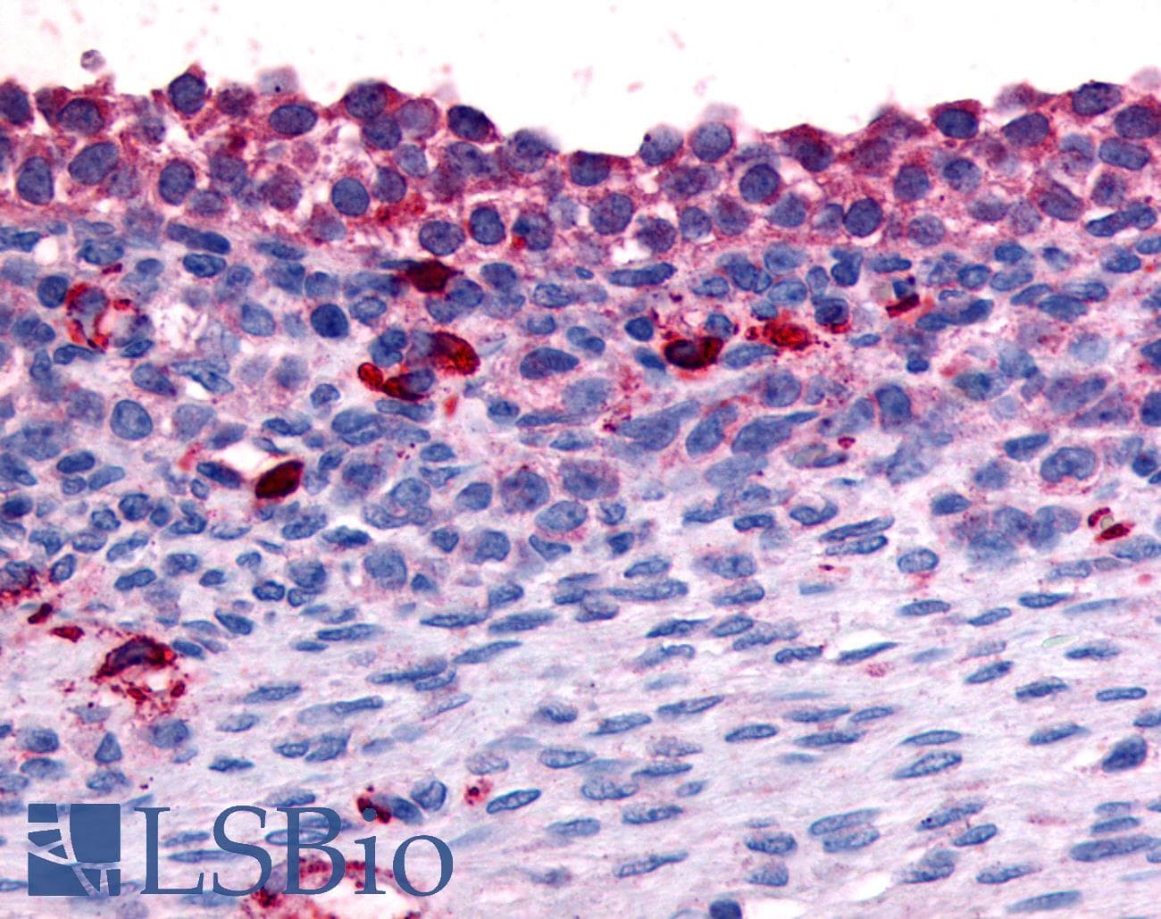 IHC-plus™ Polyclonal Rabbit anti-Human NR4A1 / NUR77 Antibody (N-Terminus, IHC)