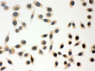 PRDX5 / Peroxiredoxin 5 Antibody