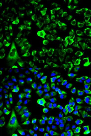 RPS3 / Ribosomal Protein S3 Antibody