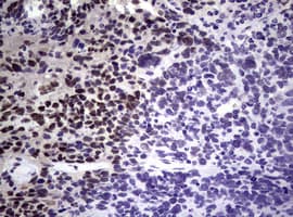 NBN / Nibrin Antibody (clone OTI6E11)