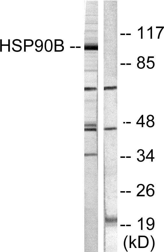 Polyclonal Rabbit anti-Human HSP90AB1 / HSP90 Alpha B1 Antibody (p254, IHC, IF, WB)