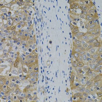 APP / Beta Amyloid Precursor Antibody