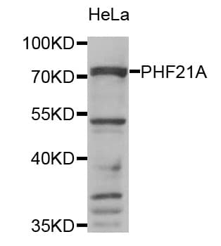 PHF21A / BHC80 Antibody