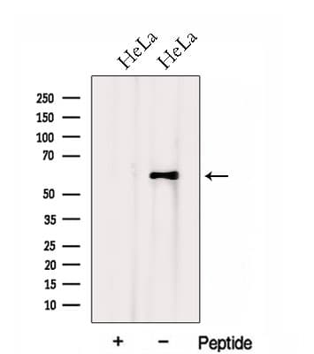 Polyclonal Rabbit anti-Human HSPA13 Antibody (WB)