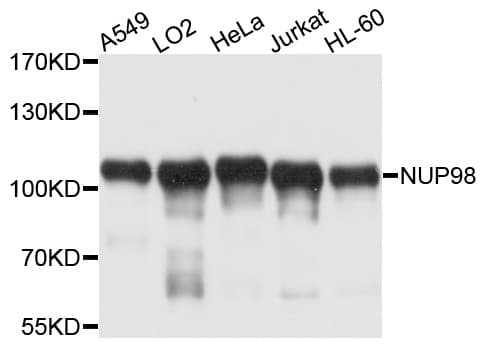 NUP98 Antibody