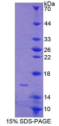 Mouse CABP2 Protein (Recombinant His-T7, N-terminus)