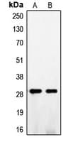 FGF5 Antibody (C-Terminus)
