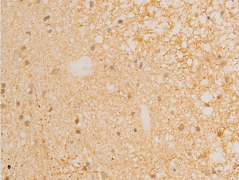 Polyclonal Rabbit anti-Human NFKBIE / IKB Epsilon Antibody (phospho-Ser22, IHC, IF, WB)