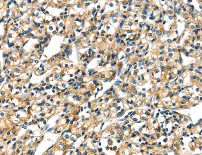 Polyclonal Rabbit anti-Human KRT17 / CK17 / Cytokeratin 17 Antibody (IHC)