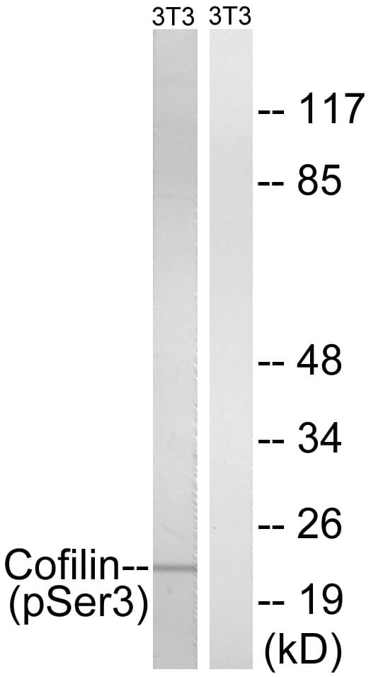 CFL1 / Cofilin Antibody (phospho-Ser3)