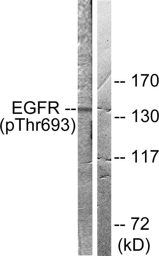 EGFR Antibody (phospho-Thr693)