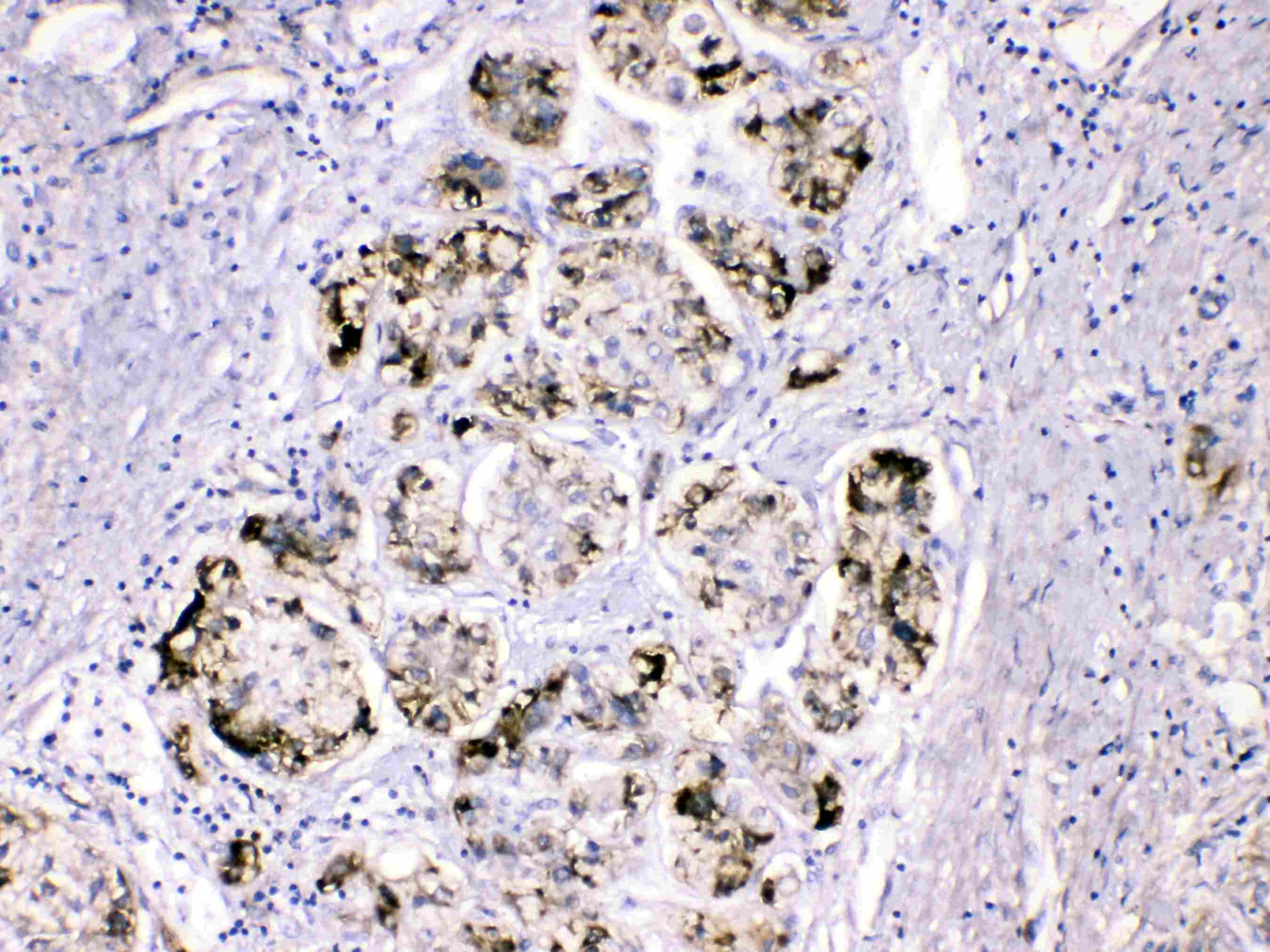 Polyclonal Rabbit anti-Human FGG / Fibrinogen Gamma Antibody (IHC, WB)