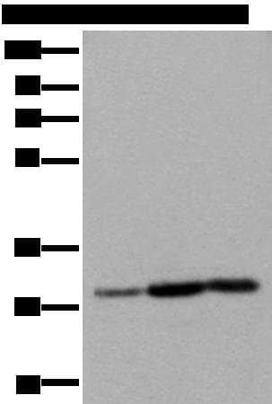 SNRPA / U1A Antibody
