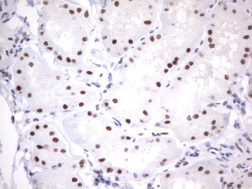 PARN Antibody (aa1-266, clone UMAB143)