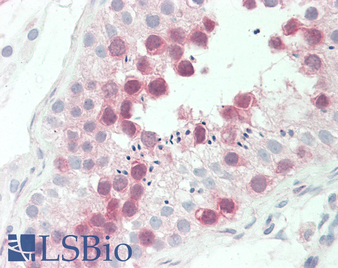 IHC-plus™ Monoclonal Mouse anti-Human MPS1 / TTK Antibody (clone 3G7, IHC, WB)