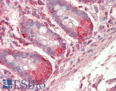 IHC-plus™ MED1 / TRAP220 Antibody (aa1525-C-term)