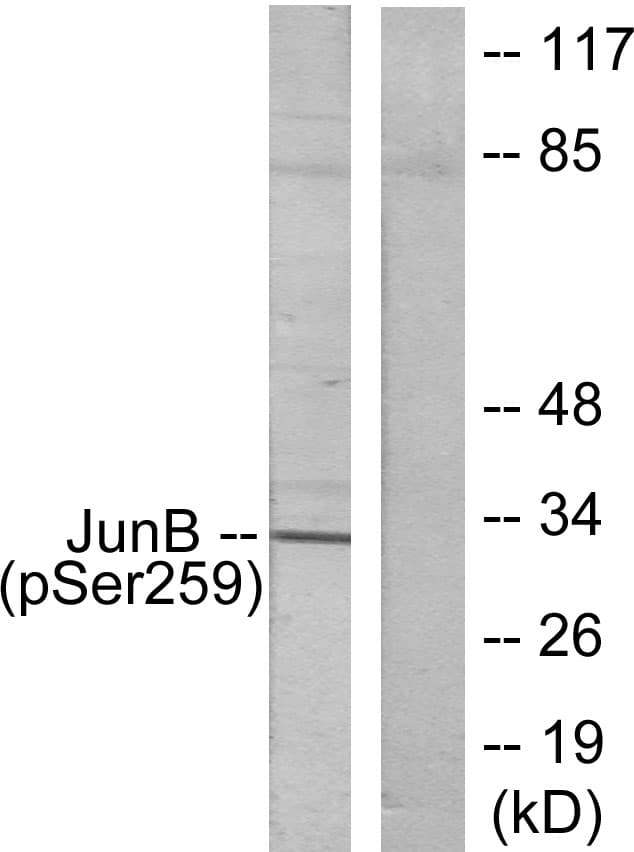 Polyclonal Rabbit anti-Human JUNB / JUN-B Antibody (phospho-Ser259, IHC, WB)