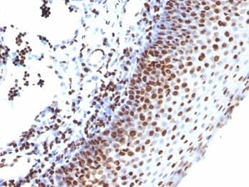 Histone H1 Antibody (clone SPM256)