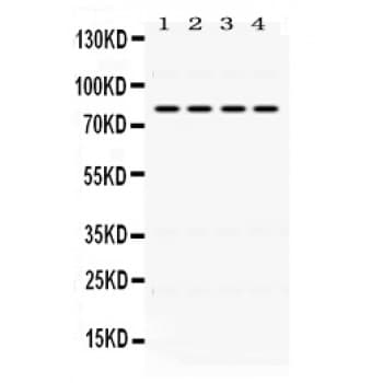 PIGR Antibody (aa579-613)