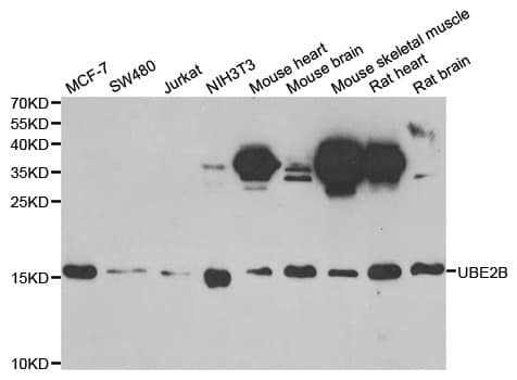 HR6B / UBE2B Antibody