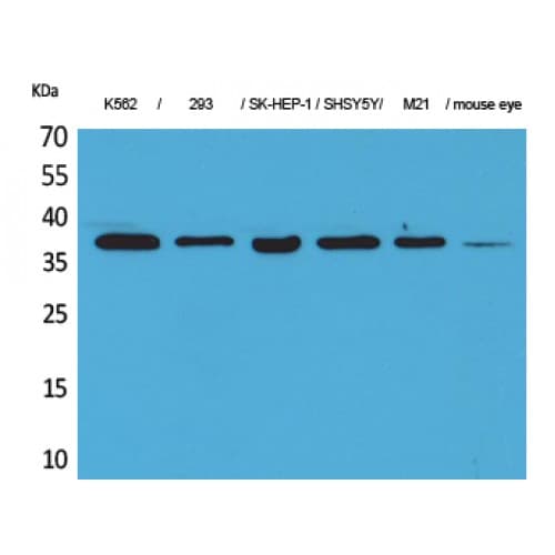 CGI-96 / RRP7A Antibody (C-terminal)