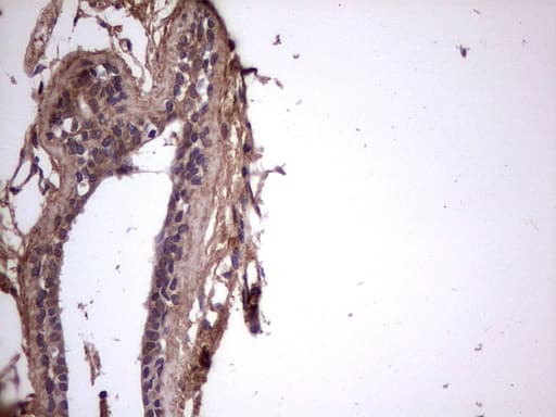 BFSP2 Antibody (aa184-415, clone OTI4E7, Carrier-free)