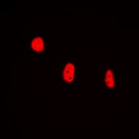 HMG20B / BRAF35 Antibody (N-Terminus)