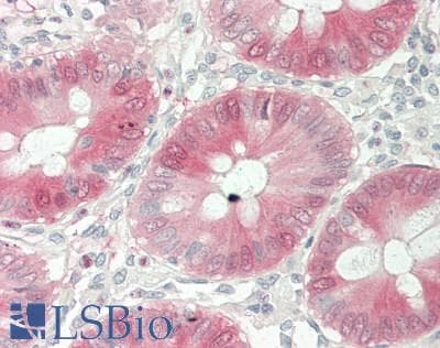 IHC-plus™ Monoclonal Mouse anti-Human LGALS3 / Galectin 3 Antibody (clone B2C10, Concentrated, IHC, WB)