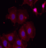 ERBB2 / HER2 Antibody