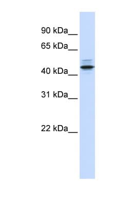 Polyclonal Rabbit anti-Human PSMC3 Antibody (aa72-121, WB)