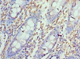 CD274 / B7-H1 / PD-L1 Antibody (aa19-238)