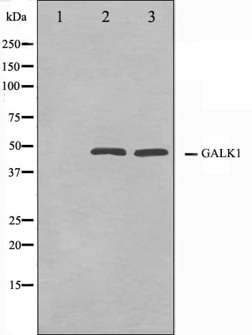 GALK1 / GK1 Antibody