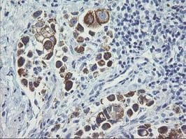 ERBB2 / HER2 Antibody (aa676-1255, clone OTI2A1, Carrier-free)