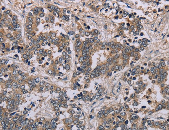 Polyclonal Rabbit anti-Human AATK / AATYK Antibody (IHC)
